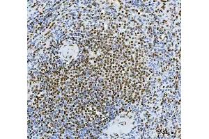 IHC analysis of Exonuclease 1/EXO1 using anti-Exonuclease 1/EXO1 antibody (ABIN7599229). (Exonuclease 1 Antikörper  (AA 1-294))