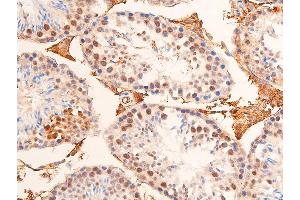 ABIN6267073 at 1/100 staining mouse testicular tissue sections by IHC-P. (CHEK1 Antikörper  (pSer280))