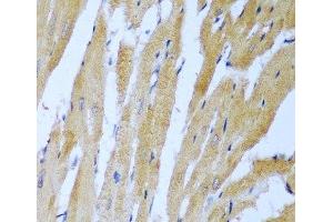 Immunohistochemistry of paraffin-embedded Rat heart using IGF2BP3 Polyclonal Antibody at dilution of 1:100 (40x lens). (IGF2BP3 Antikörper)