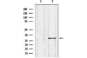 anti-RAB11B, Member RAS Oncogene Family (RAB11B) (C-Term) antibody