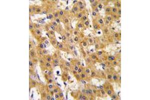 Image no. 3 for anti-Pyruvate Dehydrogenase Complex, Component X (PDHX) antibody (ABIN357415) (PDHX Antikörper)