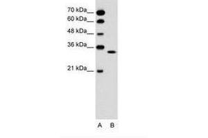 Image no. 1 for anti-Olfactory Receptor, Family 5, Subfamily T, Member 2 (OR5T2) (C-Term) antibody (ABIN6736622) (OR5T2 Antikörper  (C-Term))