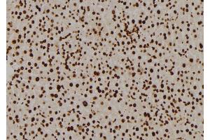 ABIN6276993 at 1/100 staining Mouse liver tissue by IHC-P. (RPL5 Antikörper  (Internal Region))