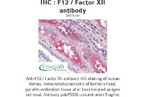 Image no. 1 for anti-Coagulation Factor XII (F12) antibody (ABIN1734212) (F12 Antikörper)