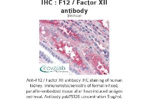 Image no. 1 for anti-Coagulation Factor XII (F12) antibody (ABIN1734212) (F12 Antikörper)