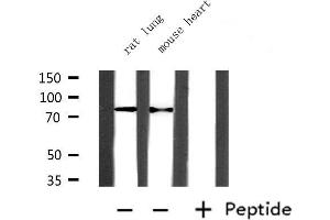 Western blot analysis of extracts from mouse heart and rat lung, using PRMT7 Antibody. (PRMT7 Antikörper  (Internal Region))