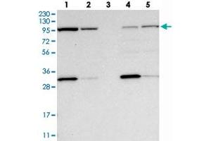 Western blot analysis of Lane 1: RT-4, Lane 2: U-251 MG, Lane 3: Human Plasma, Lane 4: Liver, Lane 5: Tonsil with EXOC2 polyclonal antibody  at 1:250-1:500 dilution. (EXOC2 Antikörper)