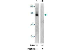 Western blot analysis of extracts from COS-7 cells, treated with PMA (125 ng/mL, 30 mins), using PRKCZ polyclonal antibody . (PKC zeta Antikörper)