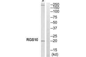 Western blot analysis of extracts from Jurkat cells, using RGS10 antibody. (RGS10 Antikörper  (Internal Region))