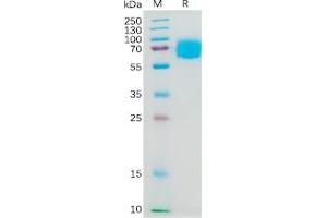 Human IL4RA Protein, hFc Tag on SDS-PAGE under reducing condition.