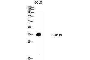 Western Blotting (WB) image for anti-G Protein-Coupled Receptor 119 (GPR119) (Internal Region) antibody (ABIN3184842) (G Protein-Coupled Receptor 119 Antikörper  (Internal Region))