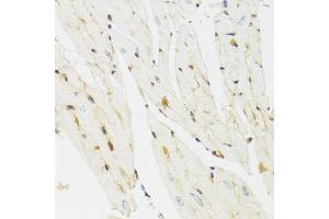 Immunohistochemistry of paraffin-embedded mouse heart using THAP1 antibody.
