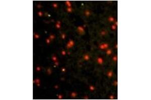 Image no. 1 for anti-Cadherin 4 (CDH4) (AA 182-211), (N-Term) antibody (ABIN356865) (Cadherin 4 Antikörper  (N-Term))