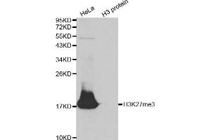 Western blot analysis of extracts of various cell lines, using Trimethyl-Histone H3-K27 antibody (ABIN5969810) at 1/500 dilution. (Histone 3 Antikörper  (H3K27me3))
