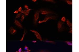 Immunofluorescence analysis of U2OS cells using TYMS Polyclonal Antibody at dilution of 1:100. (TYMS Antikörper)