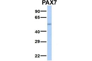 Host:  Rabbit  Target Name:  SERPINA3  Sample Type:  Human Adult Placenta  Antibody Dilution:  1. (PAX7 Antikörper  (Middle Region))