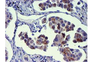 Image no. 5 for anti-Golgi Membrane Protein 1 (GOLM1) antibody (ABIN1498494) (GOLM1 Antikörper)