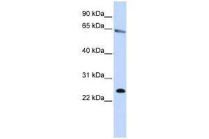 ZNF326 antibody used at 0.