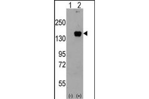 Western blot analysis of P3K5 (arrow) using rabbit polyclonal P3K5 Antibody g. (ASK1 Antikörper  (AA 821-849))