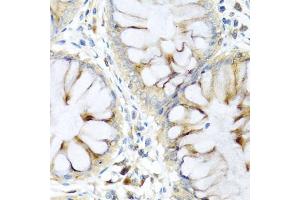 Immunohistochemistry of paraffin-embedded human colon using PI3 antibody (ABIN6132804, ABIN6145588, ABIN6145590 and ABIN6221092) at dilution of 1:100 (40x lens). (PI3 Antikörper  (AA 23-117))