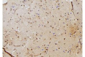 ABIN6276345 at 1/100 staining Mouse brain tissue by IHC-P. (PSME3 Antikörper  (N-Term))