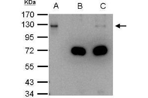 IP Image DDB1 antibody immunoprecipitates DDB1 protein in IP experiments. (DDB1 Antikörper  (C-Term))
