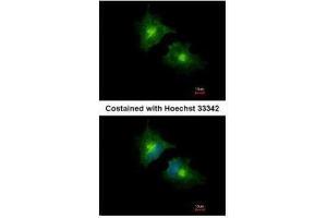 ICC/IF Image Immunofluorescence analysis of methanol-fixed HeLa, using SCAMP3, antibody at 1:1000 dilution. (SCAMP3 Antikörper)