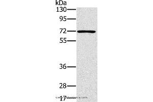 Western blot analysis of Raji cell, using PLS3 Polyclonal Antibody at dilution of 1:400 (Plastin 3 Antikörper)