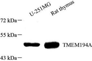 Western blot analysis of TMEM194A (ABIN7075997) at dilution of 1: 1000