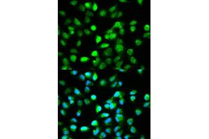 Immunofluorescence analysis of HeLa cell using TCF4 antibody. (TCF4 Antikörper)