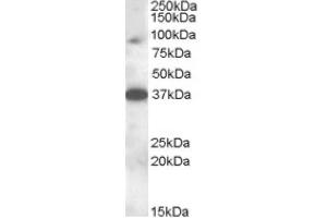 Image no. 1 for anti-Membrane-Associated Ring Finger (C3HC4) 10, E3 Ubiquitin Protein Ligase (MARCH10) (Internal Region) antibody (ABIN375020) (MARCH10 Antikörper  (Internal Region))