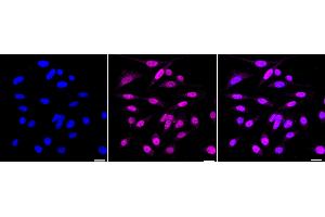 Immunocytochemical staining of HepG2 cells with JunD antibody (ABIN7799143), 1:1,000). (Rekombinanter JunD Antikörper)