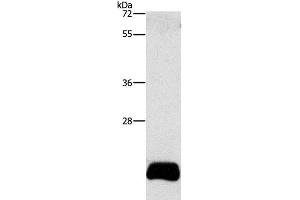 Western Blot analysis of PC3 cell using APOBEC3C Polyclonal Antibody at dilution of 1:420 (APOBEC3C Antikörper)
