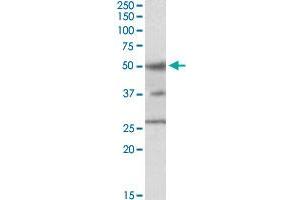 FOXA1 polyclonal antibody  staining (1 ul/mL) of HepG2 cell lysate (35 ug protein in RIPA buffer). (FOXA1 Antikörper  (C-Term))