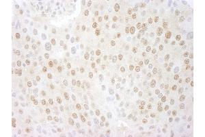 Immunohistochemistry (IHC) image for anti-COP9 Constitutive Photomorphogenic Homolog Subunit 5 (Arabidopsis) (COPS5) (AA 175-225) antibody (ABIN7448494) (COPS5 Antikörper  (AA 175-225))