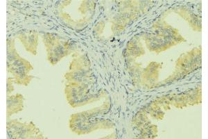ABIN6273028 at 1/100 staining Mouse colon tissue by IHC-P. (SLC30A6 Antikörper  (Internal Region))
