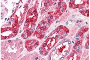 Human Kidney (formalin-fixed, paraffin-embedded) stained with MID2 antibody ABIN337007 at 5 ug/ml followed by biotinylated anti-goat IgG secondary antibody ABIN481715, alkaline phosphatase-streptavidin and chromogen. (Midline 2 Antikörper  (AA 723-735))