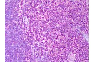 Anti-IL-2 antibody IHC of human thymus.