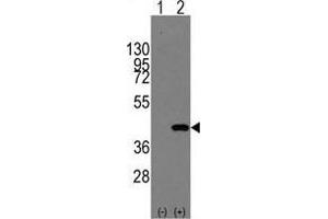 Western blot analysis of MAPK14(arrow) using rabbit polyclonal MAPK14 Antibody (Y322) . (MAPK14 Antikörper  (Tyr322))