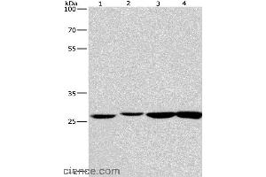 Western blot analysis of Humna colon cancer and mouse kidney tissue, mouse testis and human fetal brain tissue, using KLF7 Polyclonal Antibody at dilution of 1:483.