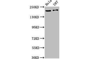 Western Blot Positive WB detected in: Hela whole cell lysate, U87 whole cell lysate All lanes: SCN10A antibody at 12 μg/mL Secondary Goat polyclonal to rabbit IgG at 1/50000 dilution Predicted band size: 221 kDa Observed band size: 221 kDa (SCN1A Antikörper  (AA 992-1099))