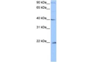 Western Blotting (WB) image for anti-Chromosome 4 Open Reading Frame 33 (C4orf33) antibody (ABIN2463479) (C4orf33 Antikörper)