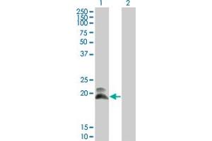 Western Blot analysis of HAND2 expression in transfected 293T cell line by HAND2 monoclonal antibody (M01), clone 4H8. (HAND2 Antikörper  (AA 135-216))