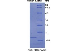 SDS-PAGE analysis of Human IL18R1 Protein. (IL18R1 Protein)