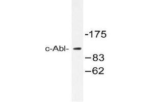 Western blot analysis of c-Abl Antibody in extracts from 293 cells. (ABL1 Antikörper)