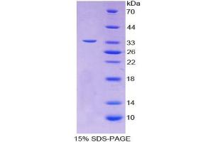 Image no. 1 for Glycoprotein Ib (Platelet), alpha Polypeptide (GP1BA) (AA 19-291) protein (T7 tag,His tag) (ABIN4988604) (CD42b Protein (AA 19-291) (T7 tag,His tag))