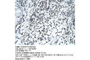 Human kidney (SIRT5 Antikörper  (Middle Region))