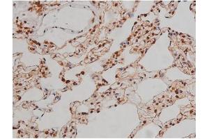 ABIN6267336 at 1/200 staining Rat lung tissue sections by IHC-P. (IGF1R Antikörper  (pTyr1346))