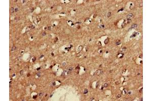 Immunohistochemistry of paraffin-embedded human brain tissue using ABIN7153954 at dilution of 1:100 (GAD65 Antikörper  (AA 1-82))