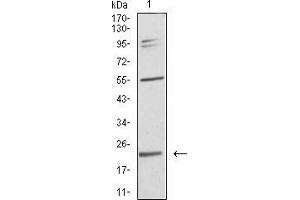 Western blot analysis using IL28A mouse mAb against SK-Br-3 (1) cell lysate.